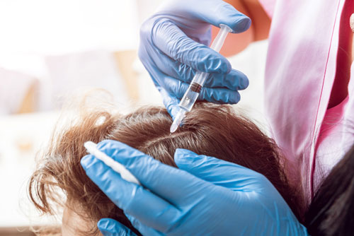 Eigenblutbehandlung bei Haarausfall